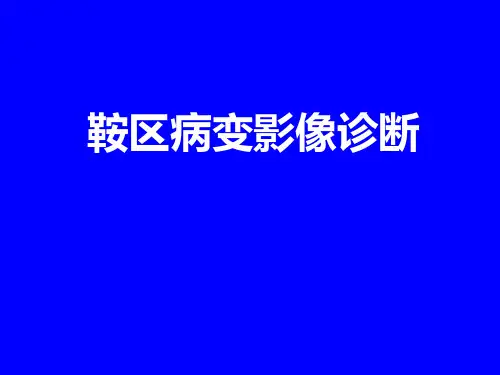 鞍区