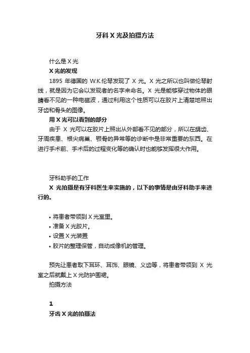 牙科X光及拍摄方法