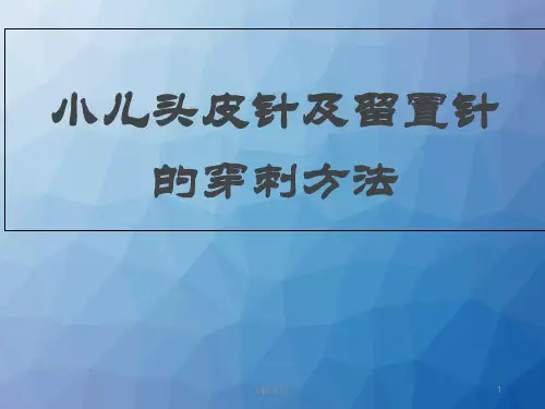 小儿头皮针剂留置针穿刺方法  ppt课件