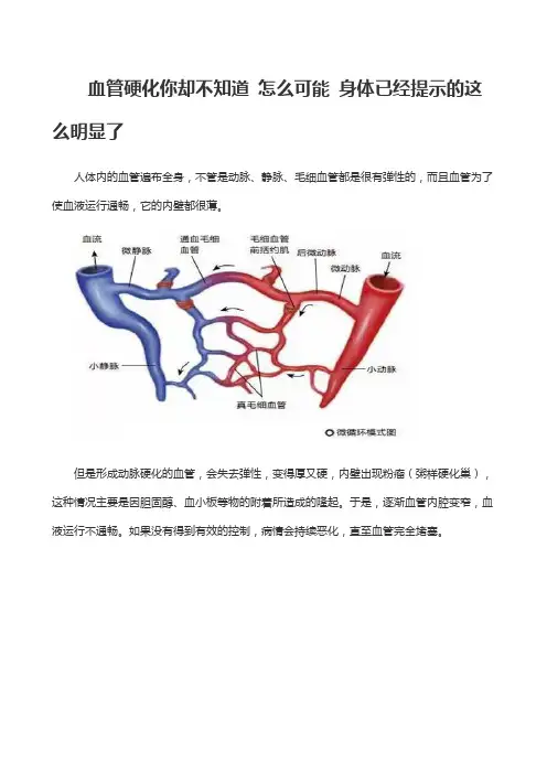 血管硬化你却不知道 怎么可能 身体已经提示的这么明显了