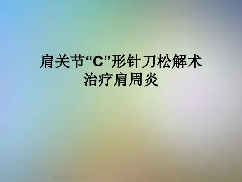 肩关节“C”形针刀松解术治疗肩周炎