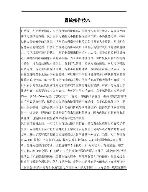 胃镜操作技巧