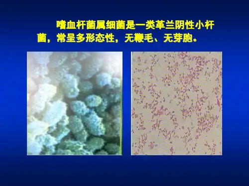 医学课件第15章嗜血杆菌属