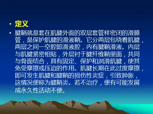 手部腱鞘炎PPT课件