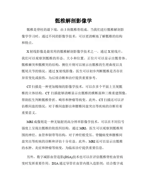 骶椎解剖影像学