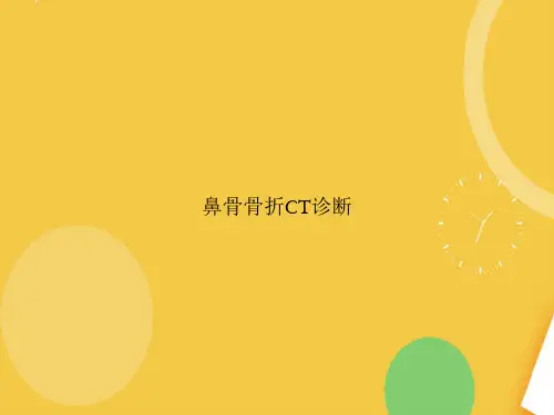 鼻骨骨折CT诊断.完整PPT资料