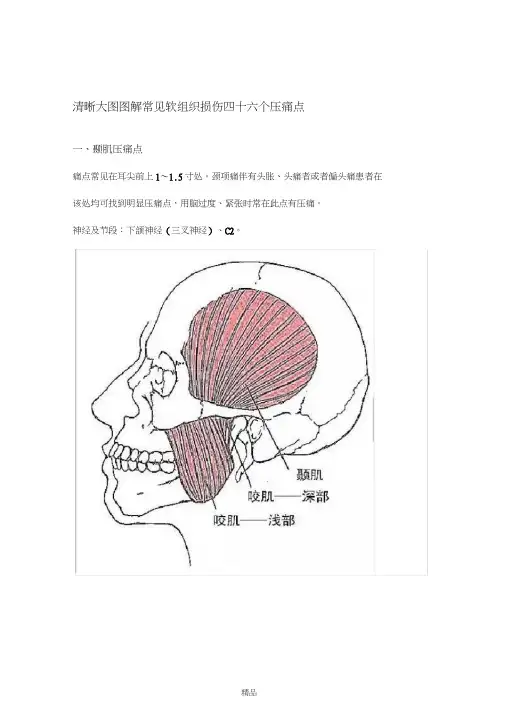 清晰大图图解常见软组织损伤四十六个压痛点