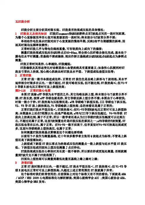 另类心电图学讲义ST段分析