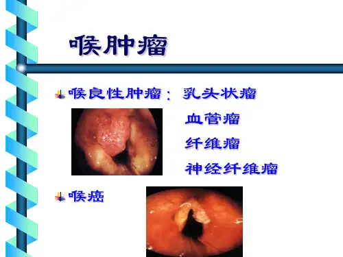 喉部临床常见肿瘤
