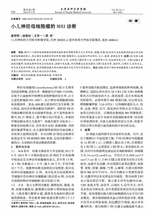 小儿神经母细胞瘤的MRI诊断