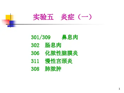 病理实验考试5炎症PPT课件