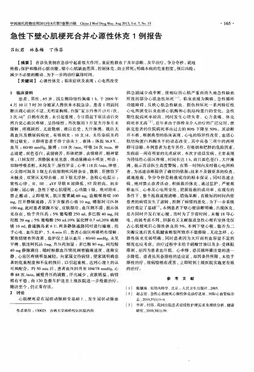 急性下壁心肌梗死合并心源性休克1例报告