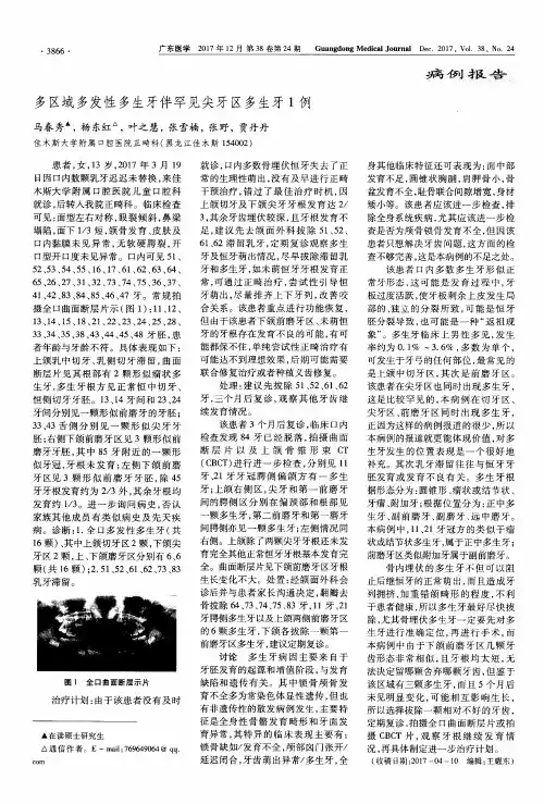 多区域多发性多生牙伴罕见尖牙区多生牙1例