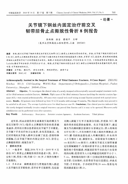 关节镜下钢丝内固定治疗前交叉韧带胫骨止点撕脱性骨折8例报告