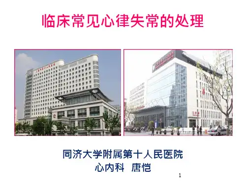 临床各科室常见心律失常的处理 文档预览