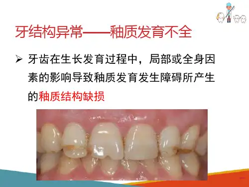牙发育异常—牙结构异常(口腔组织病理学课件)