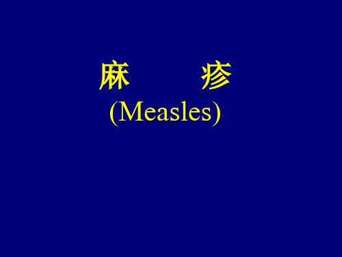 麻疹