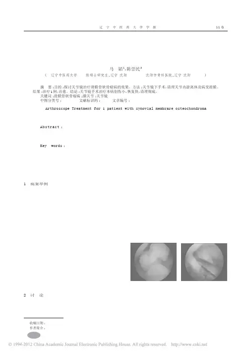 关节镜治疗膝关节滑膜骨软骨瘤病1例报道_马韬