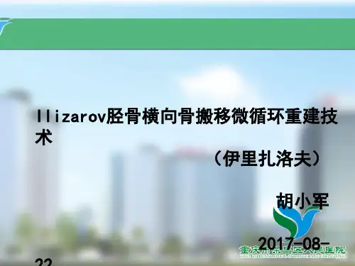 Ilizarov胫骨横向骨搬移微循环重建技术知识讲解