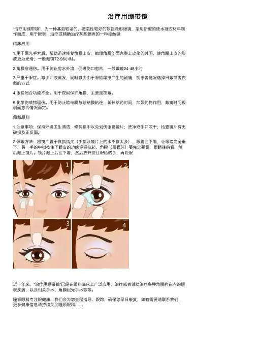 治疗用绷带镜