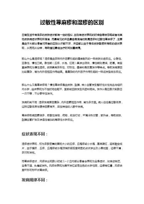 过敏性荨麻疹和湿疹的区别