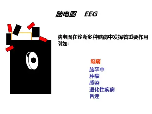 脑电图及其临床应用ppt课件