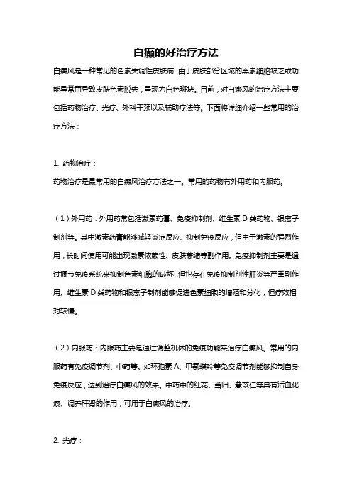 白癫的好治疗方法
