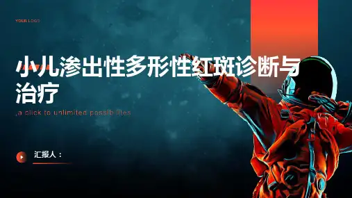 小儿渗出性多形性红斑诊断与治疗PPT