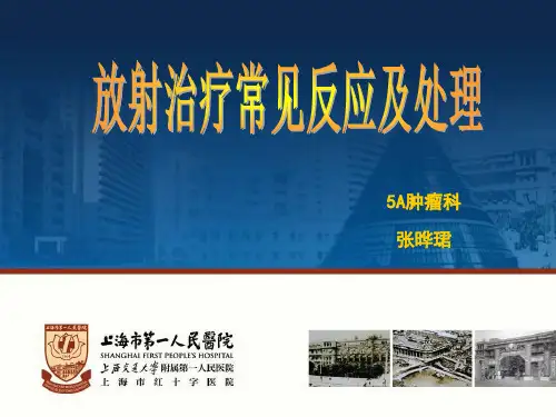 放射治疗常见反应及处理