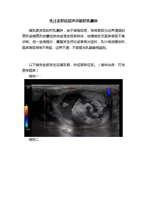 乳汁淤积症超声诊断积乳囊肿