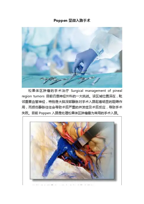 Poppen显微入路手术
