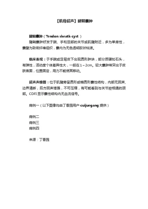 【肌骨超声】腱鞘囊肿