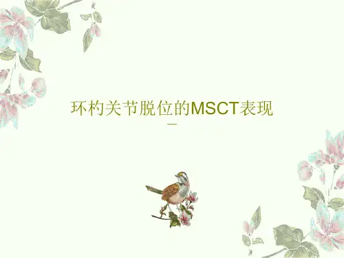 环杓关节脱位的MSCT表现共118页文档