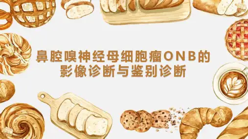鼻腔嗅神经母细胞瘤ONB的影像诊断与鉴别诊断