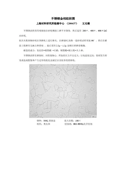 不锈钢金相组织图-1