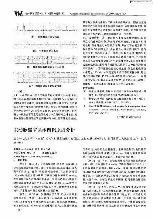 主动脉缩窄误诊四例原因分析