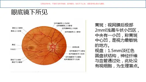 黄斑水肿护理查房课件