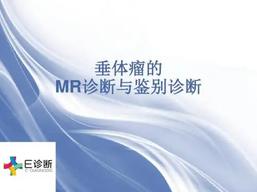 医学影像-垂体瘤的MR诊断与鉴别