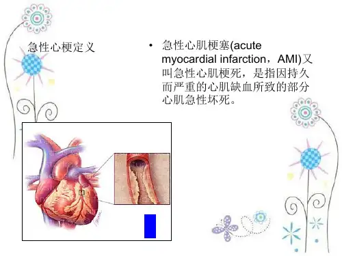 急性心梗急诊行PCI术中配合ppt课件