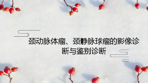 颈动脉体瘤、颈静脉球瘤的影像诊断与鉴别诊断
