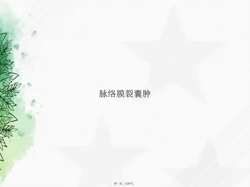 脉络膜裂囊肿讲课文档