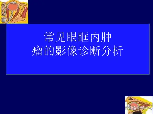常见眼眶内肿瘤的影像诊断分析
