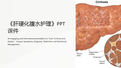 《肝硬化腹水护理》课件
