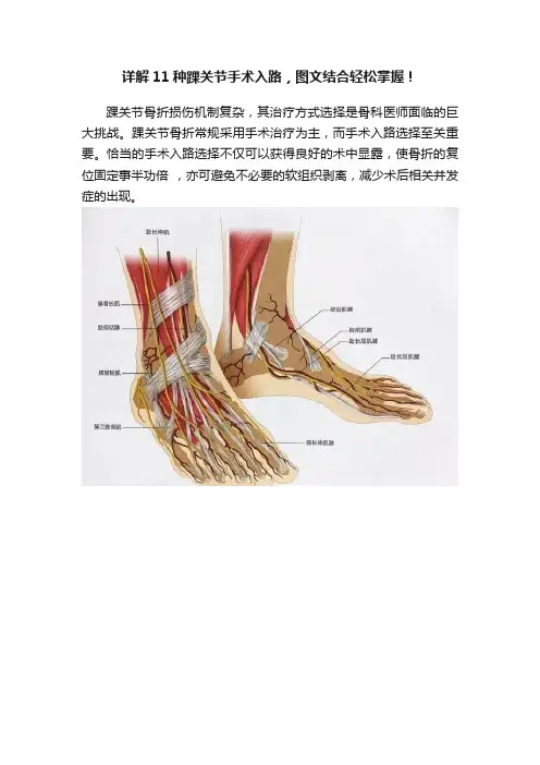 详解11种踝关节手术入路，图文结合轻松掌握！
