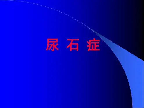 培训学习资料-尿石症_2022年学习资料