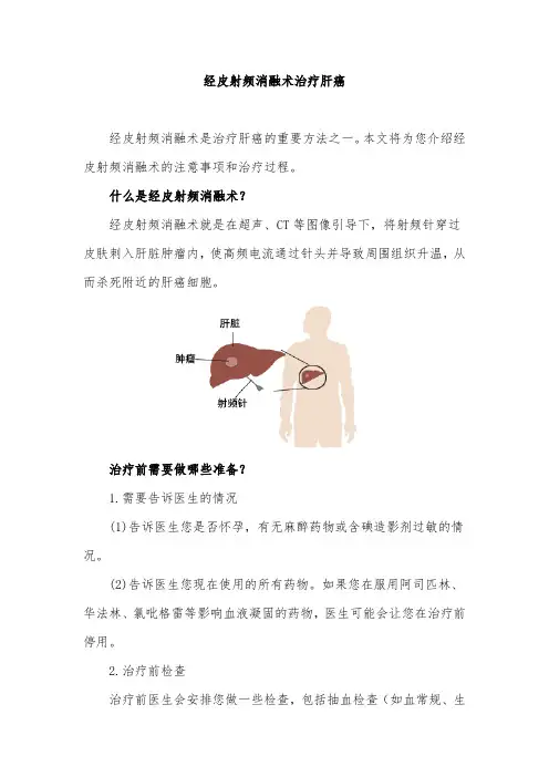 经皮射频消融术治疗肝癌
