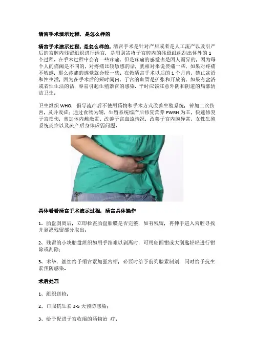 清宫手术演示过程