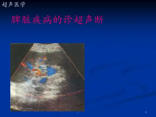 超声诊断学脾脏PPT课件