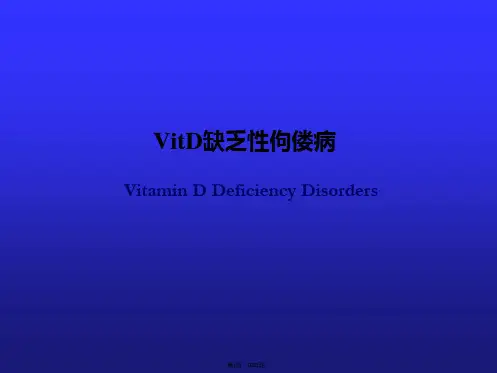 VitD缺乏性佝偻病(共55张)