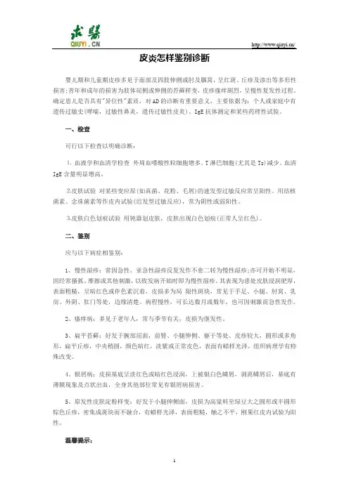 皮炎怎样鉴别诊断